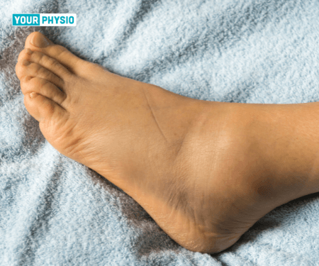 The Complete Guide To Ankle Sprain PT (Physiotherapy)